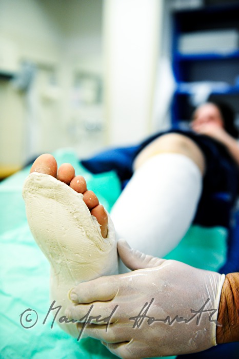 patient with broken leg in the accident department