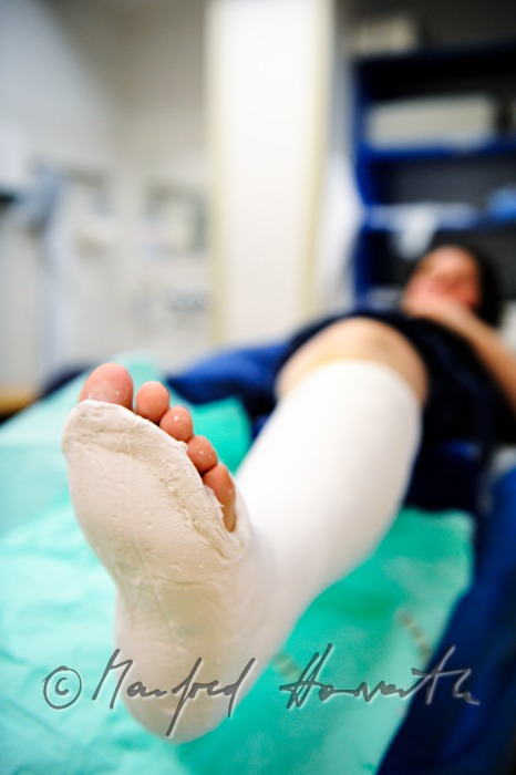 patient with broken leg in the accident department
