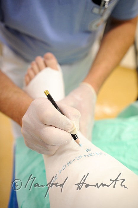 patient with broken leg in the accident department