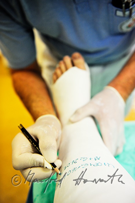 patient with broken leg in the accident department