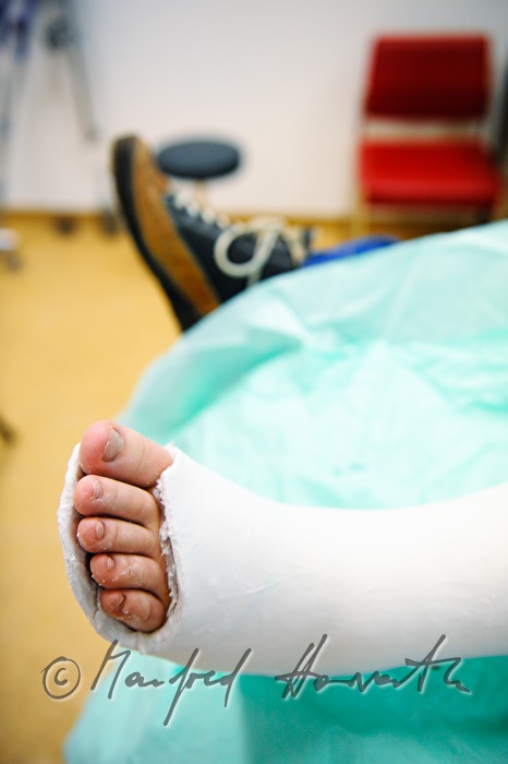 patient with broken leg in the accident department