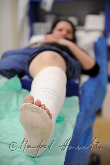 patient with broken leg in the accident department
